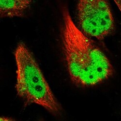 SLC38A9 Antibody, Novus Biologicals 0.1mL; Unlabeled:Antibodies, Polyclonal